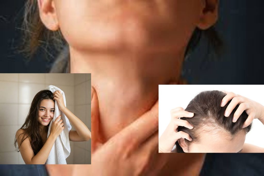 hair loss due to thyroid